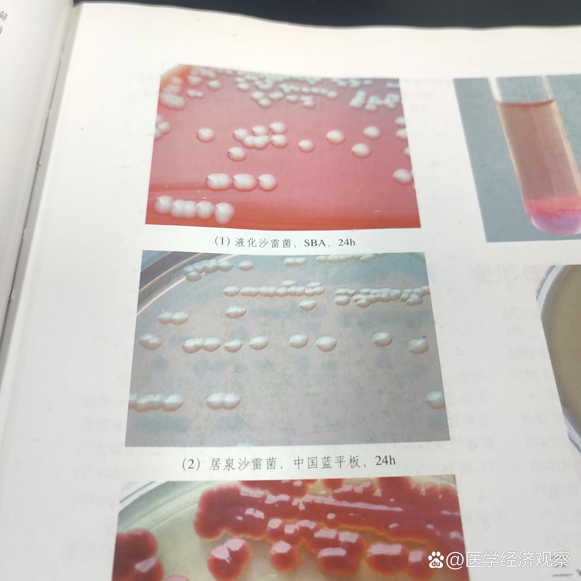 临床微生物检验菌落形态特征