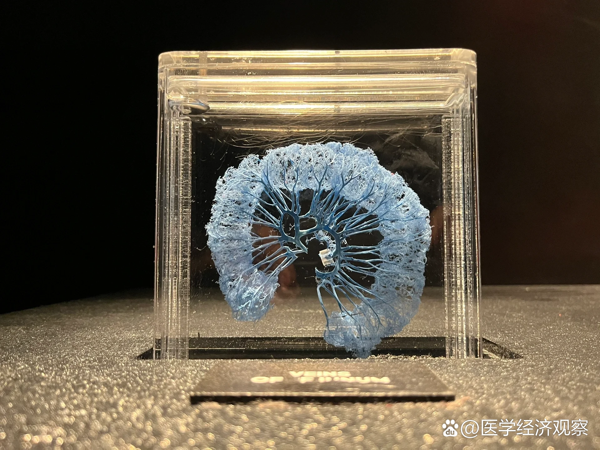 vegas人体标本展02猎奇美学9915胆小者慎入