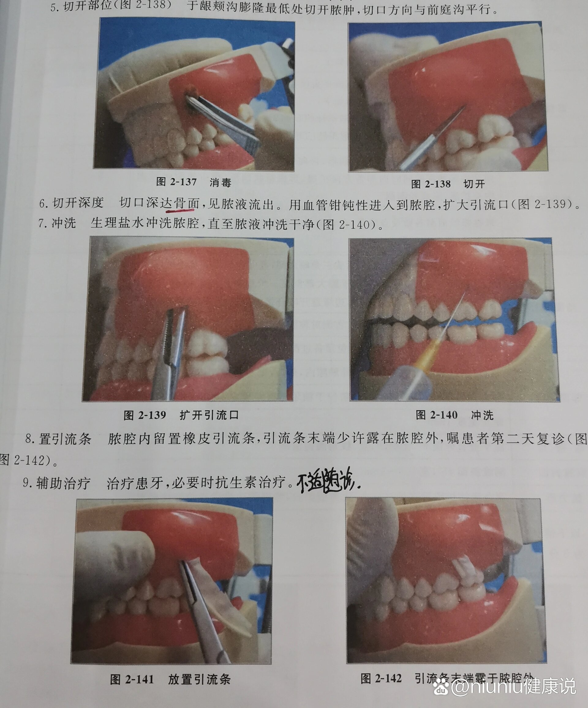 牙槽黏膜发炎图片