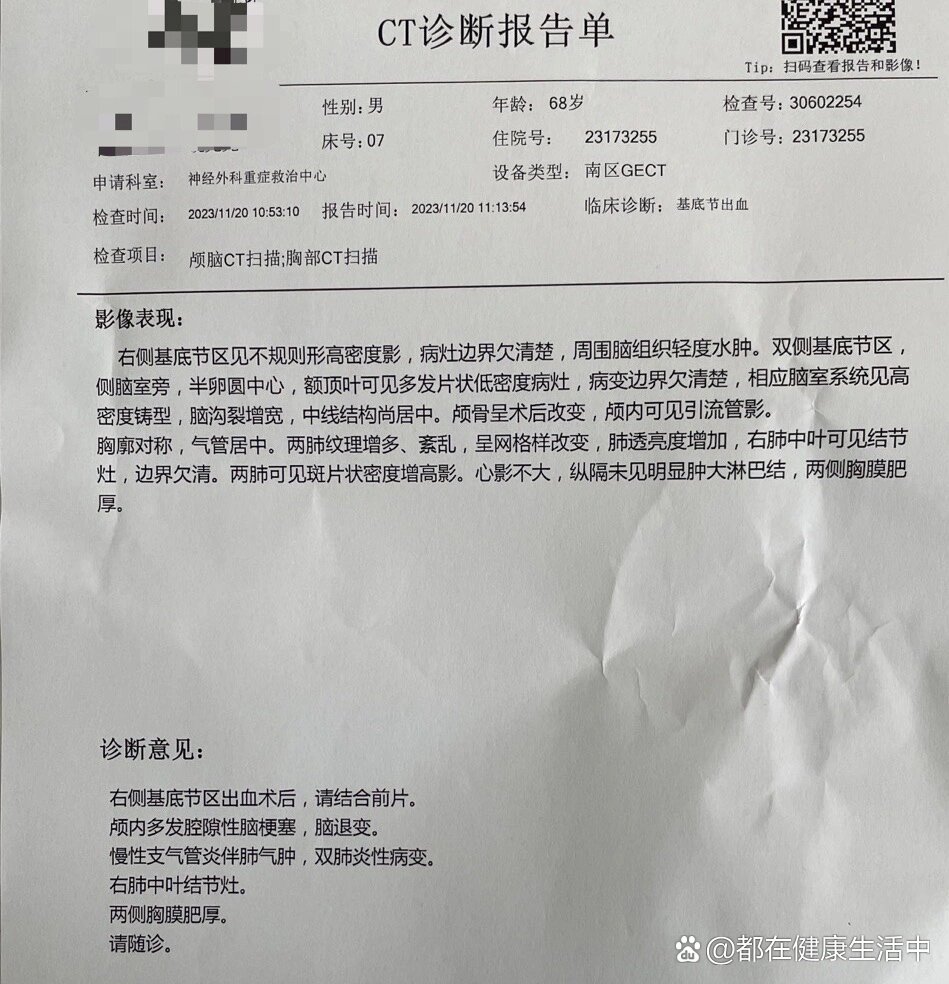 我爸右侧基底节出血20ml,这是两次微创手术之后一天的ct报告,现在重症