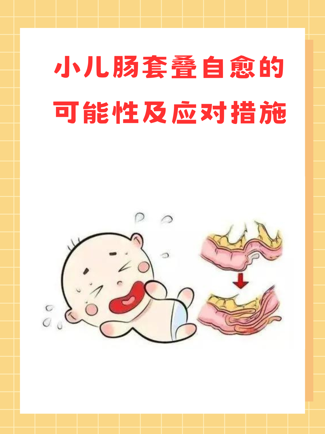 宝宝肠套叠肚子硬包图图片