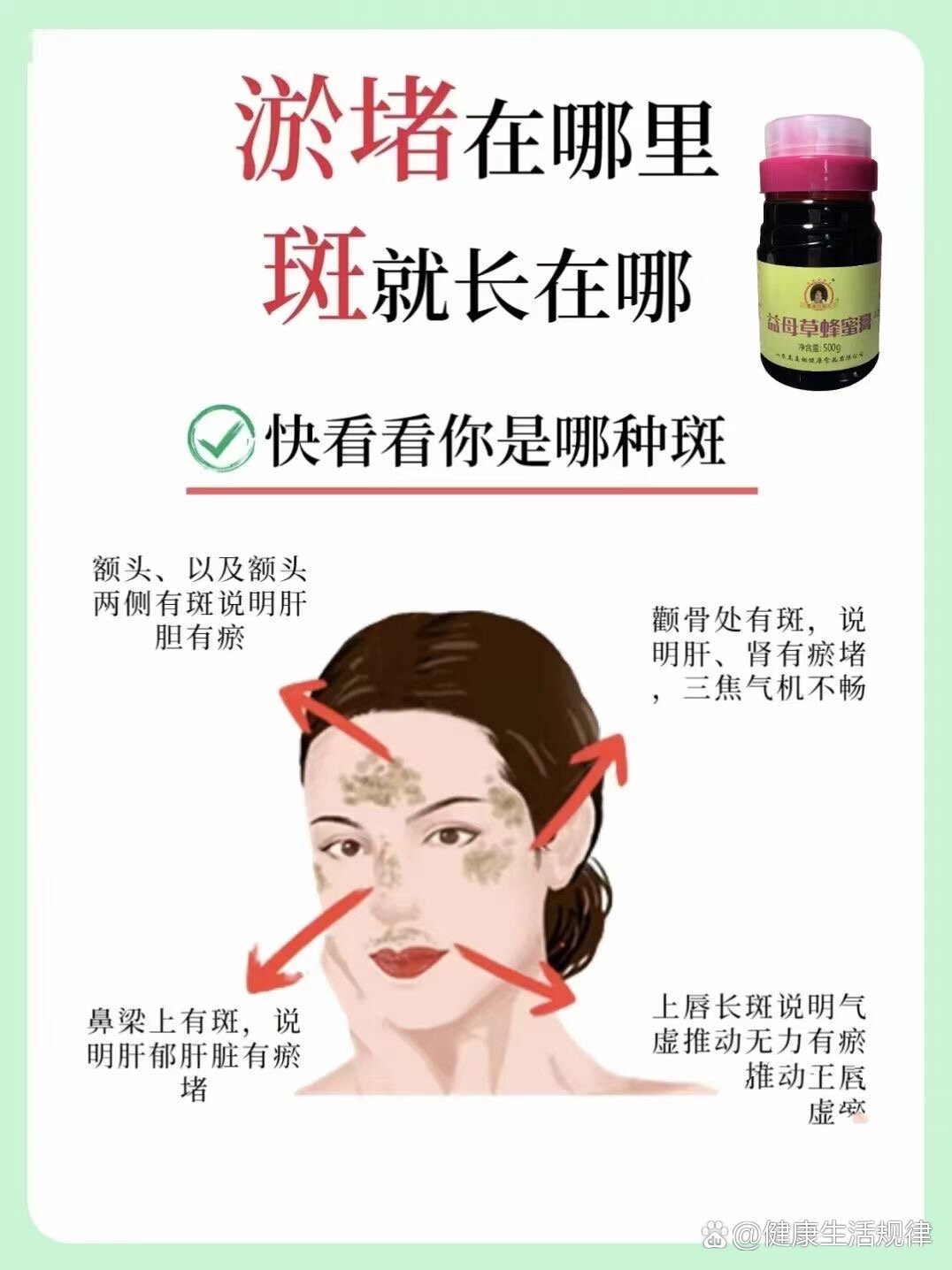 黄褐斑形成的四个原因08值得收藏!