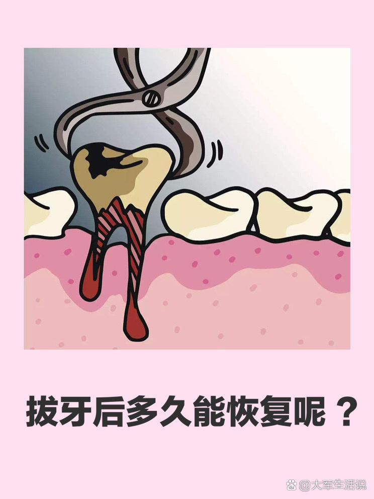 拔牙后,大概多久能够恢复呢?