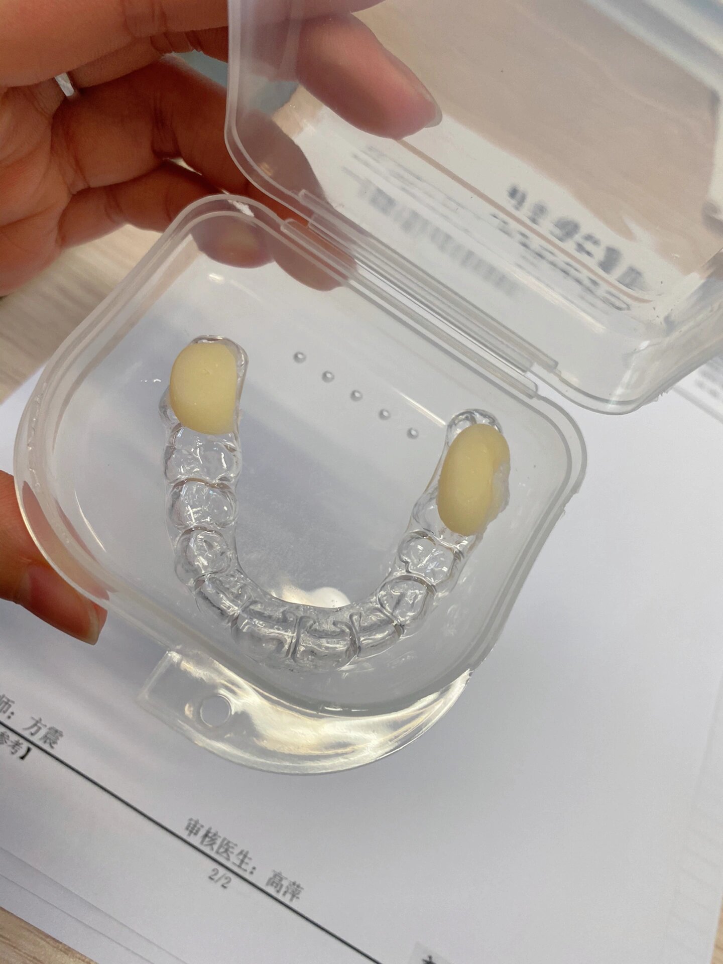 颞下颌关节紊乱(五)——颌垫