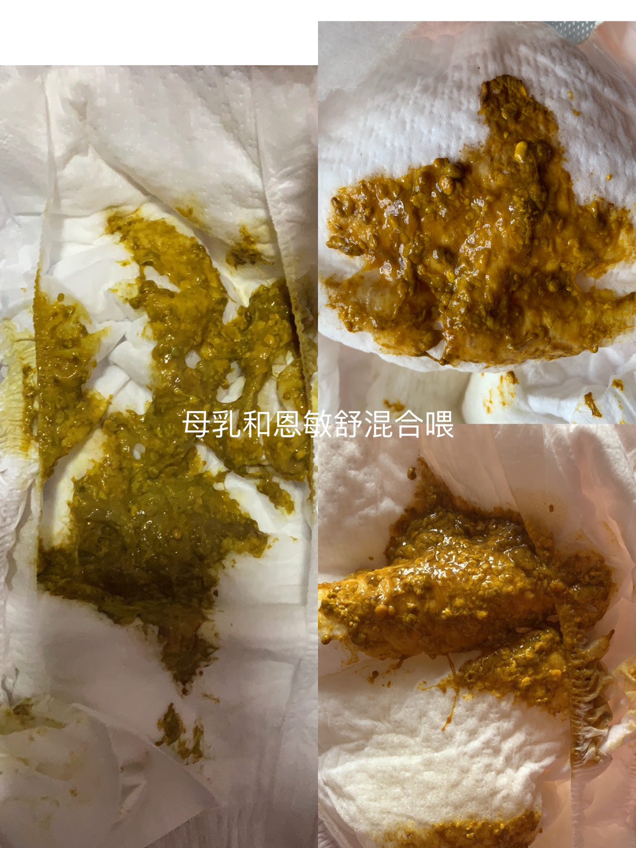 牛奶蛋白过敏的过程及大便图集(一)