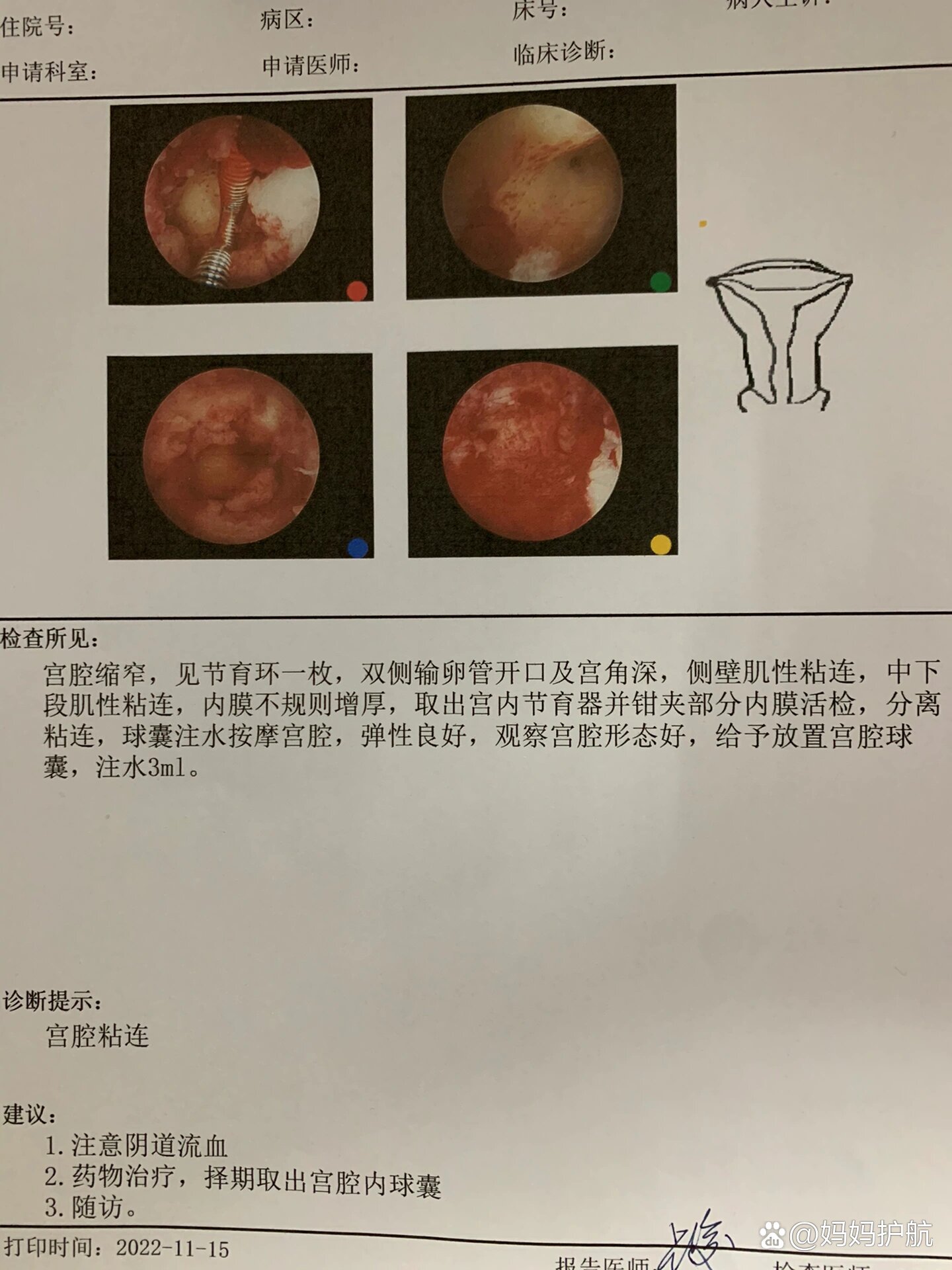 记录怀孕到宫腔重度粘连的治疗之路(3)