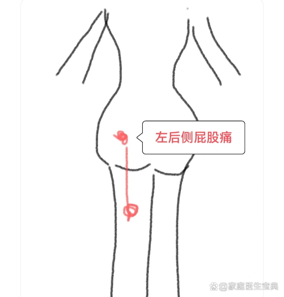 屁股疼挂号什么科(屁股疼挂什么号挂哪个科室)