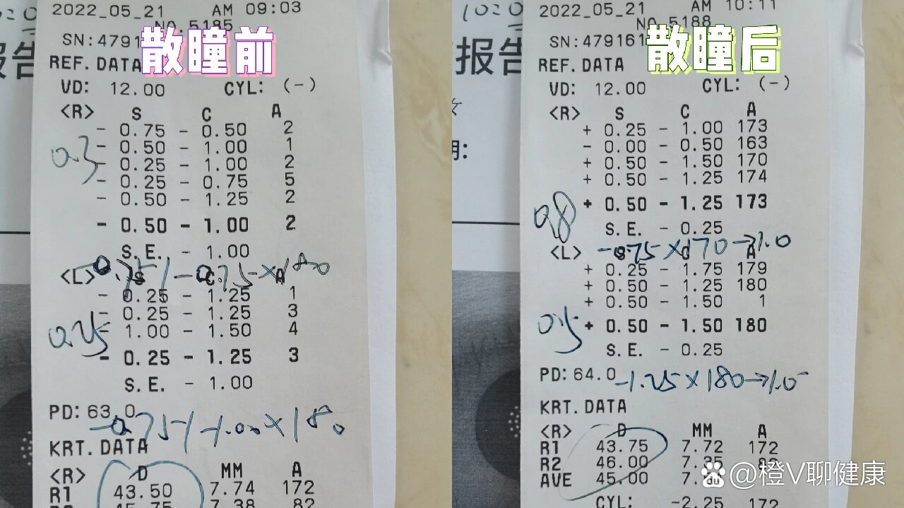 不散瞳验光结果准确吗