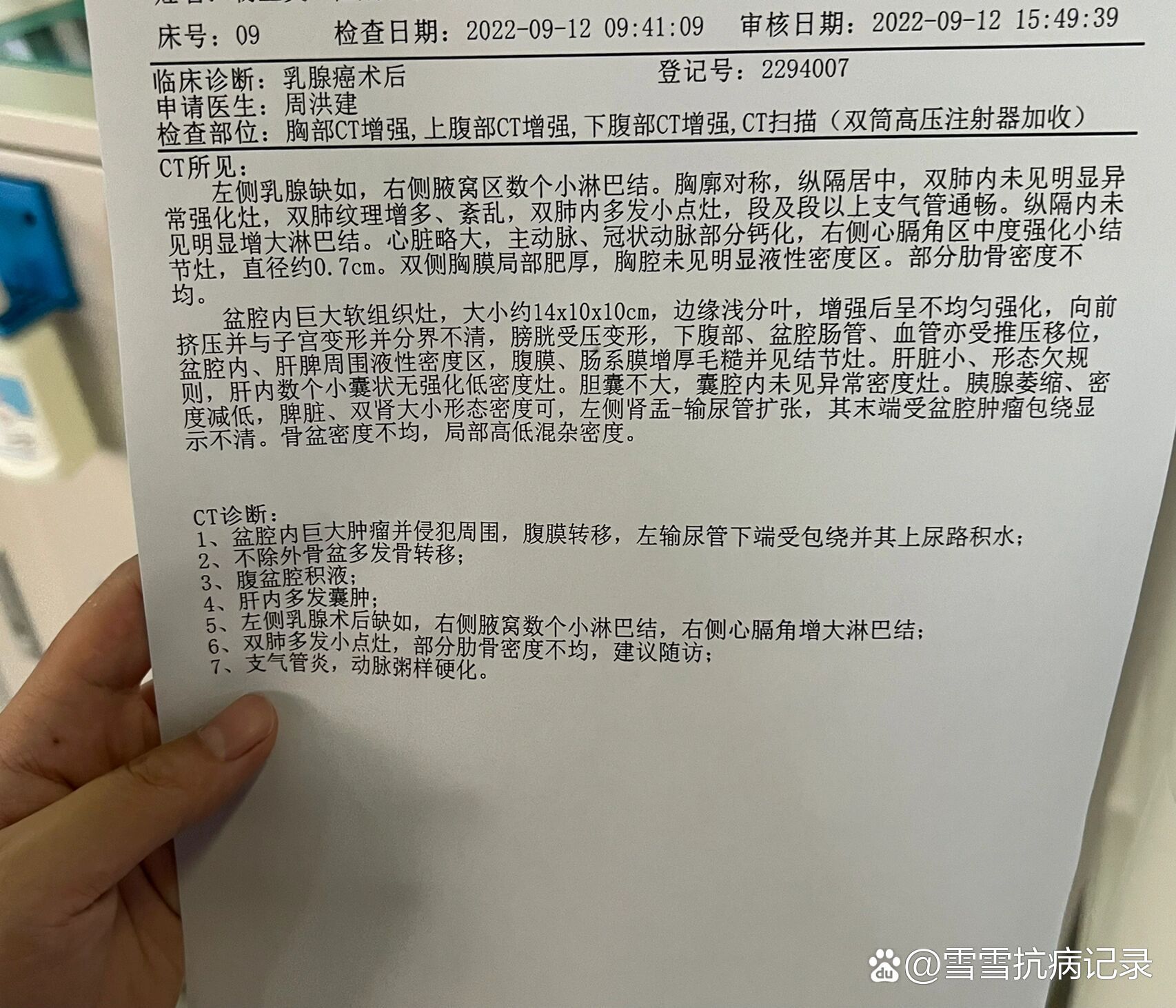 婆婆昨天确诊癌症晚期,盆腔内巨大肿瘤