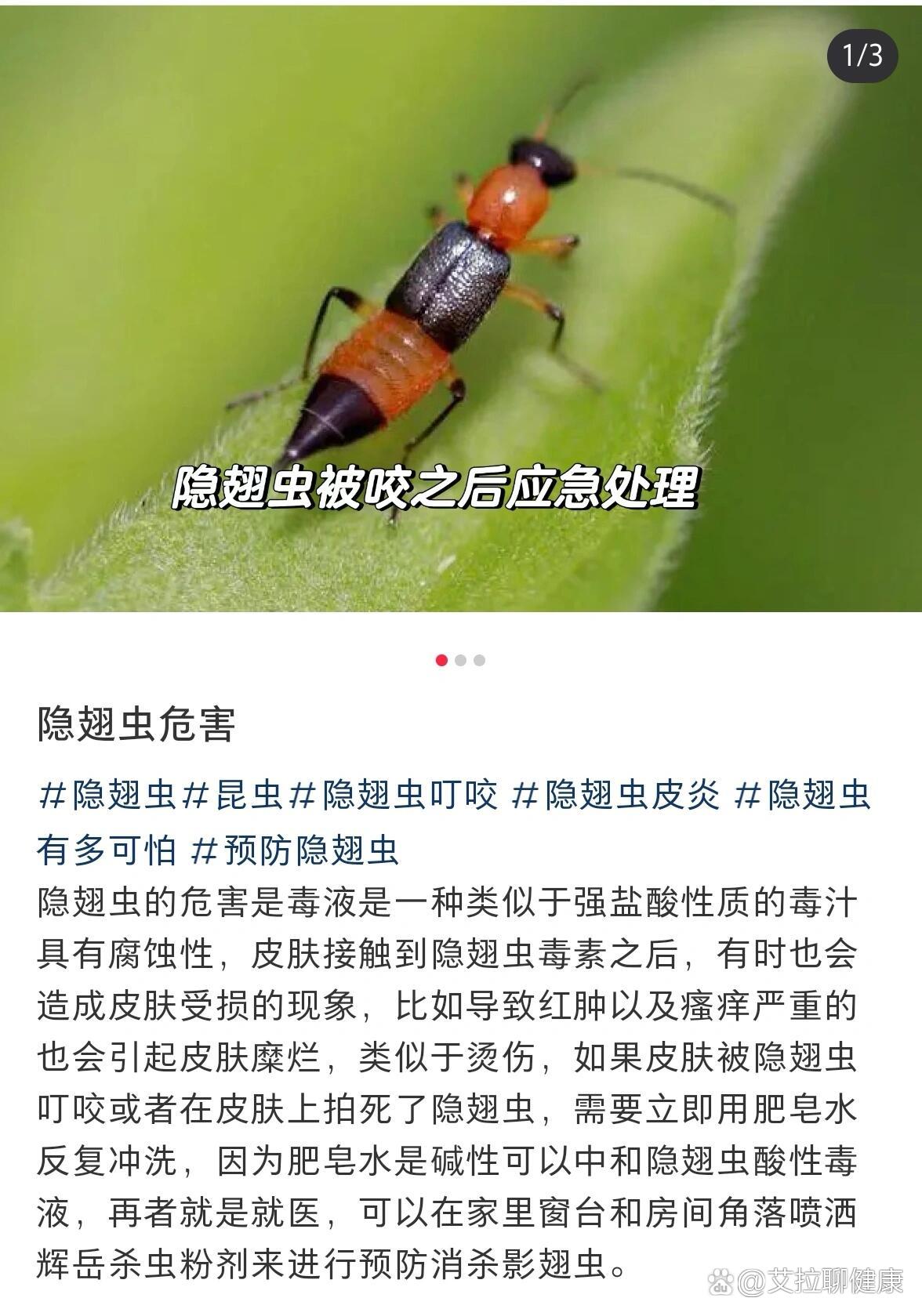 今天就刷到关于最近很多人被隐翅虫爬过或者咬了或者徒手拍死后就会被
