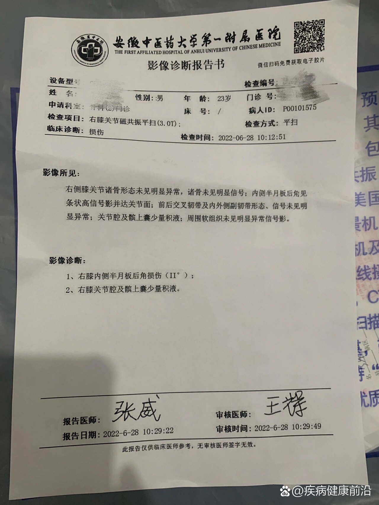 半月板二级损伤小半年,病发原因和恢复过程