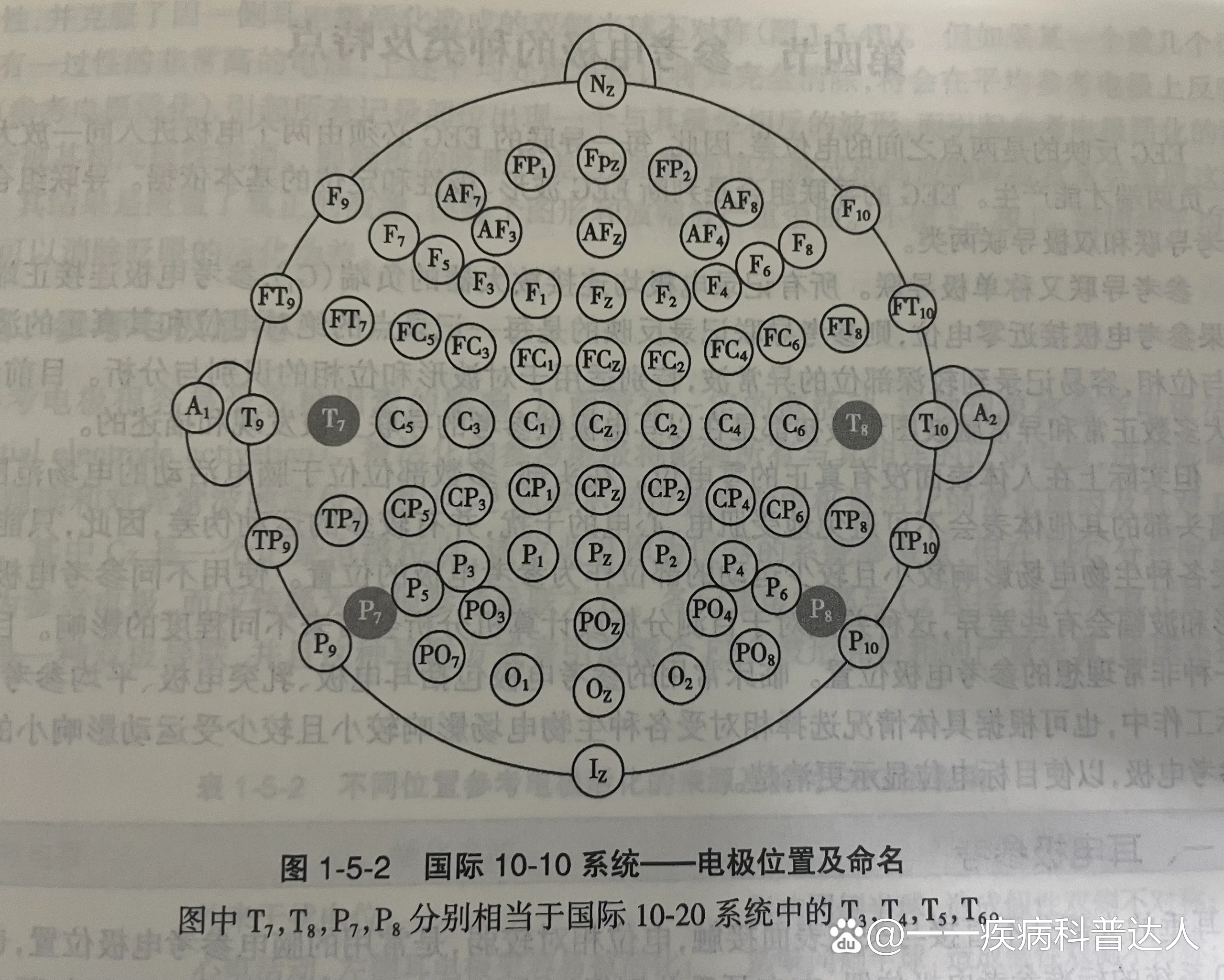 三导联示意图图片