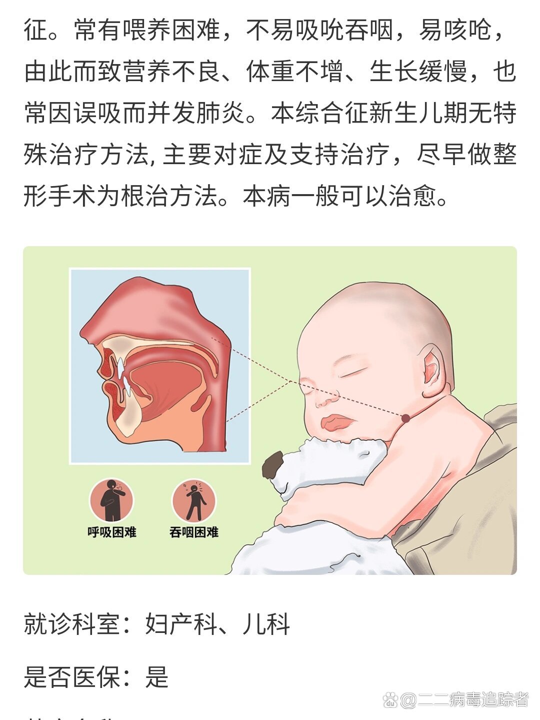 婴儿小下巴,舌头后坠的宝妈们一定要注意了