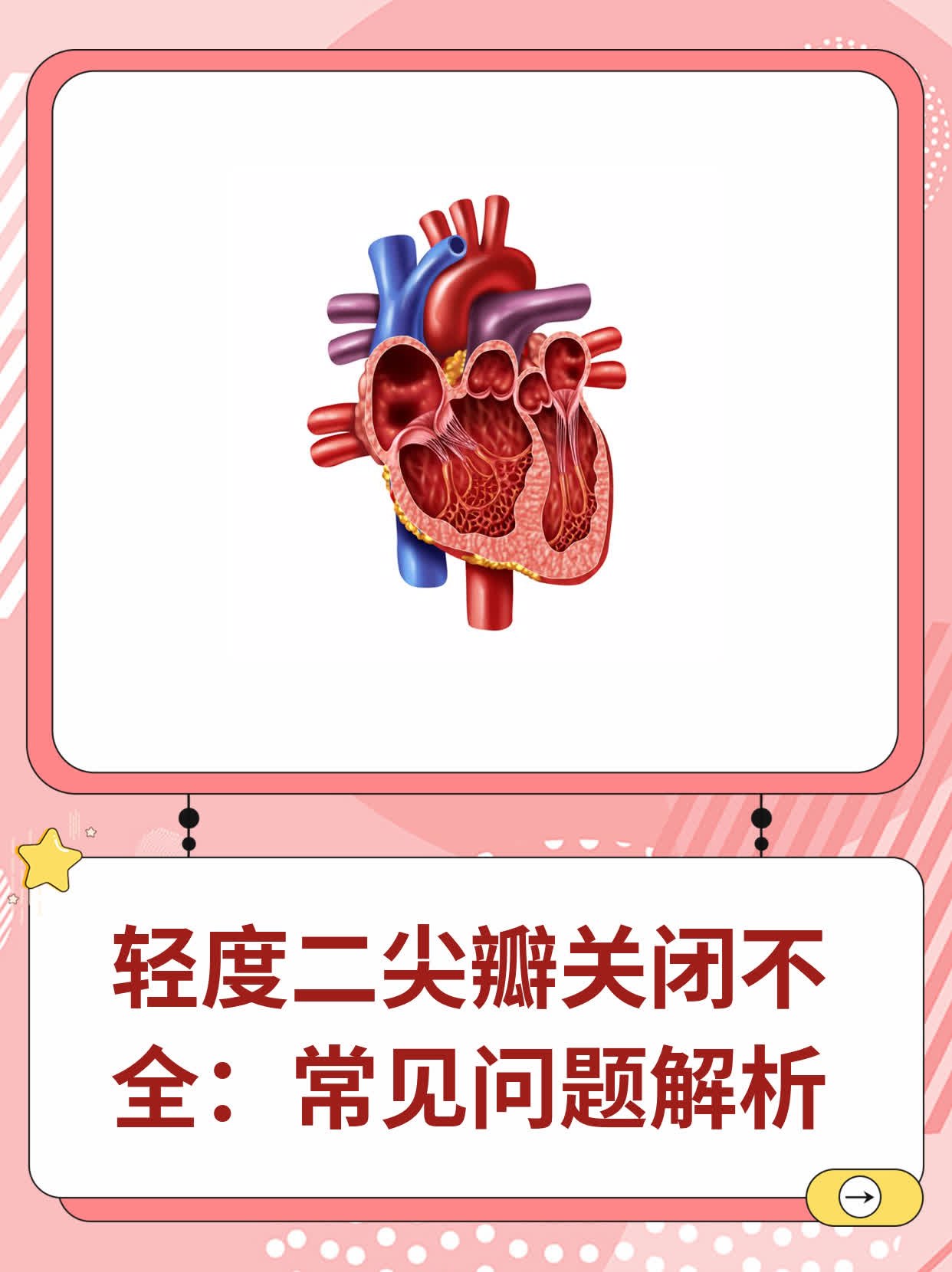 二尖瓣位置低垂图片