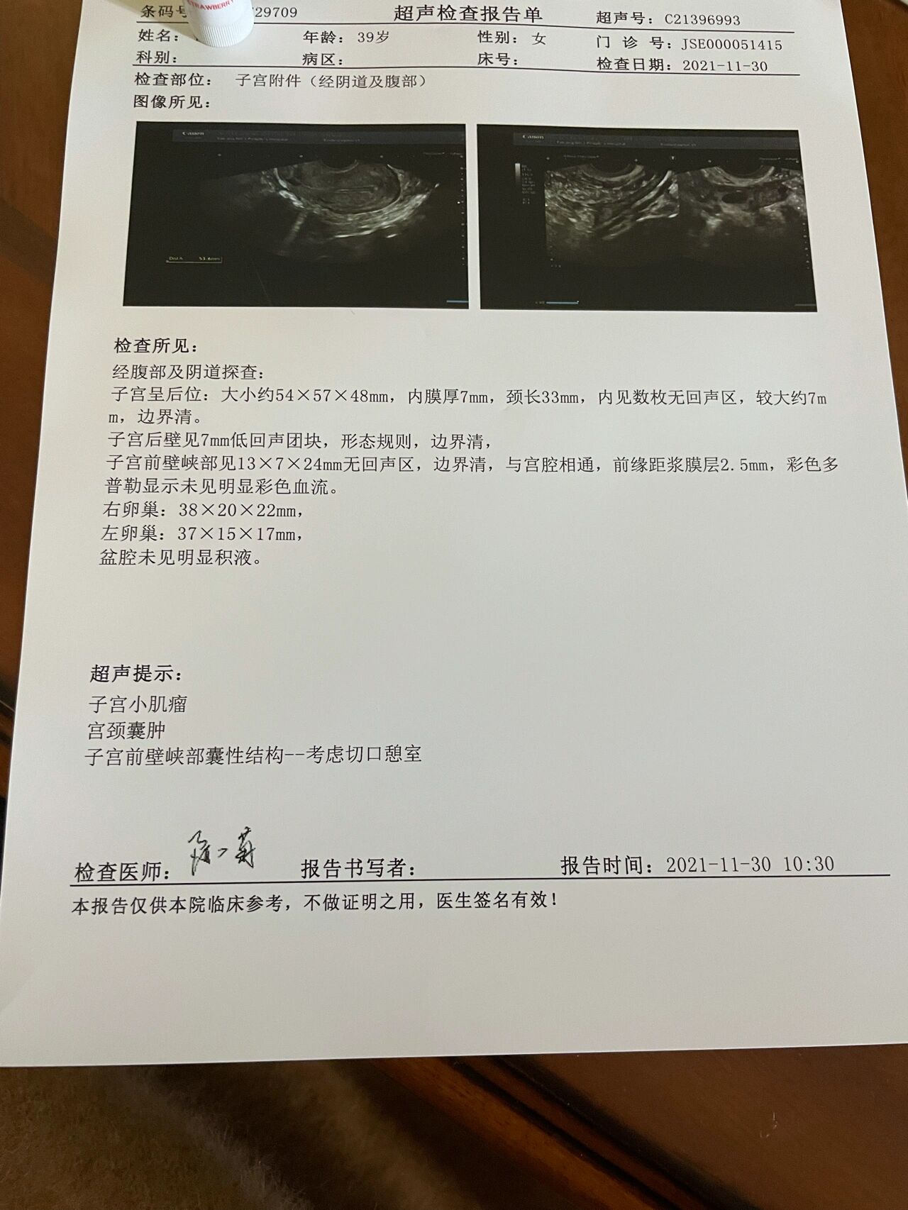 长这么大第二次做阴超,本以为自己有可能有子宫肌瘤,没想到真的是有一