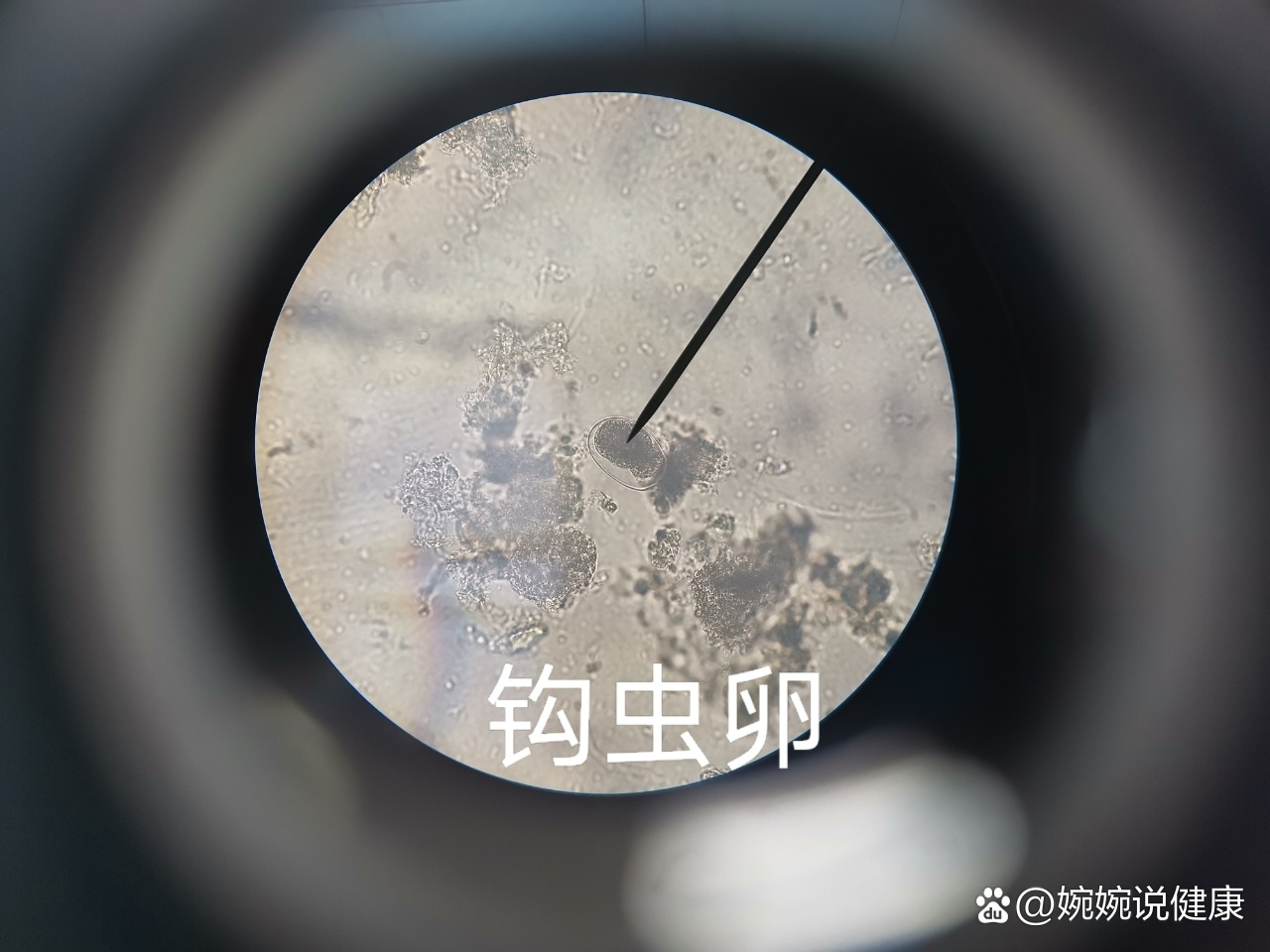 显微镜下各种寄生虫虫卵.