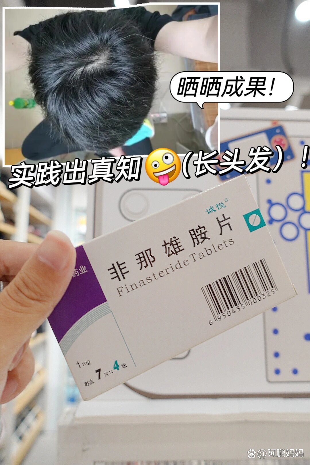 吃非那雄胺到底有没有用?