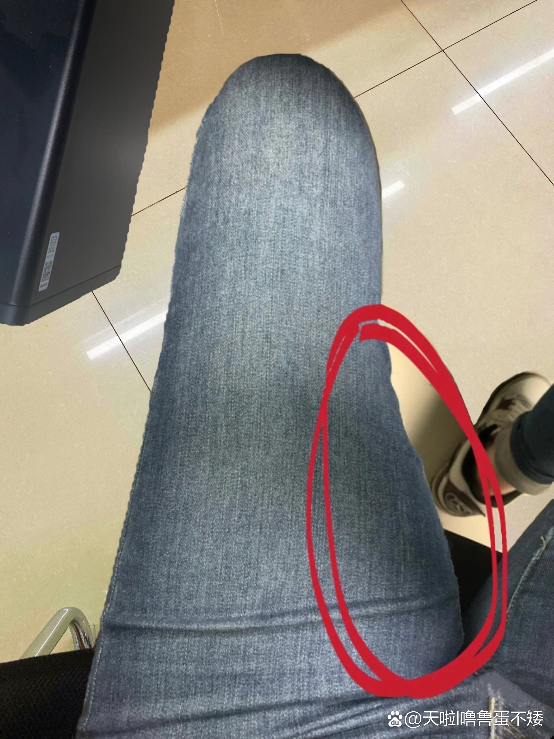 尤其是穿牛仔裤走路大腿内侧磨得好难受,去看了看才知道是湿气重代谢