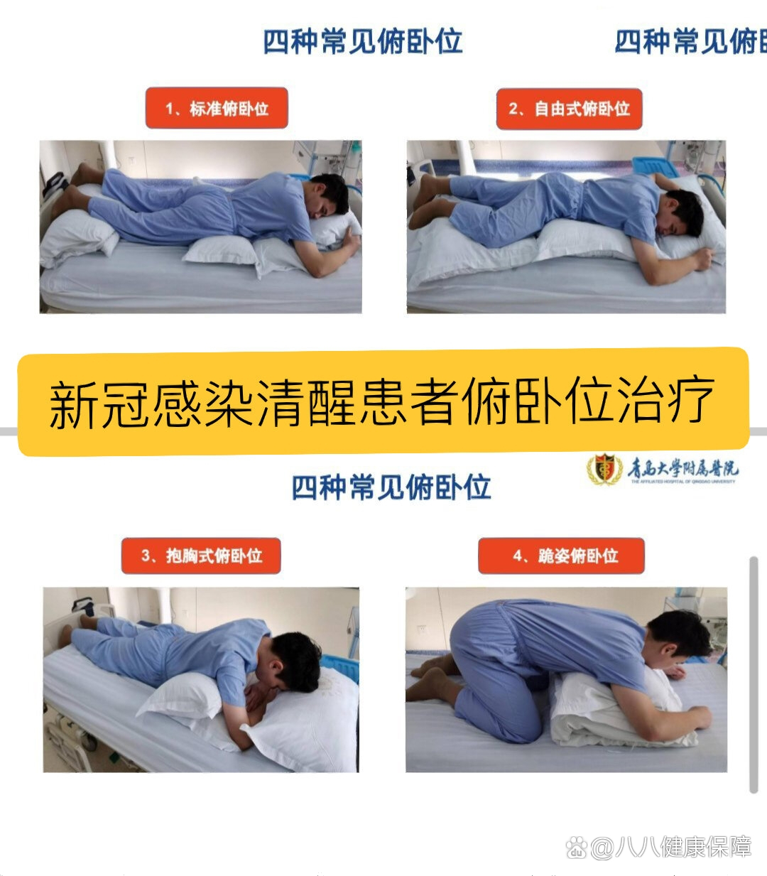 新冠感染清醒患者俯卧位治疗