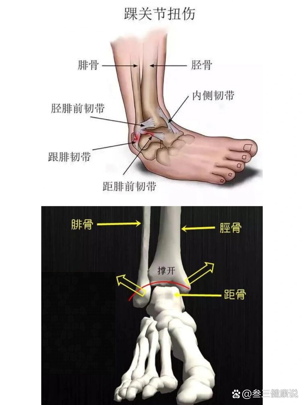 腓骨的位置图图片