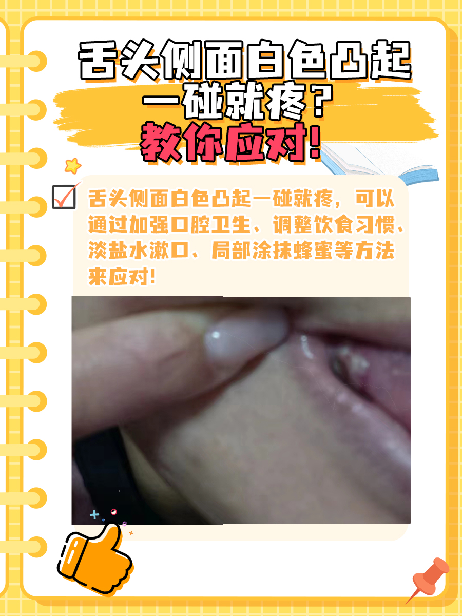 舌头侧面白色凸起一碰就疼?教你应对!