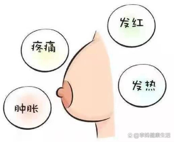 什么是乳晕图片