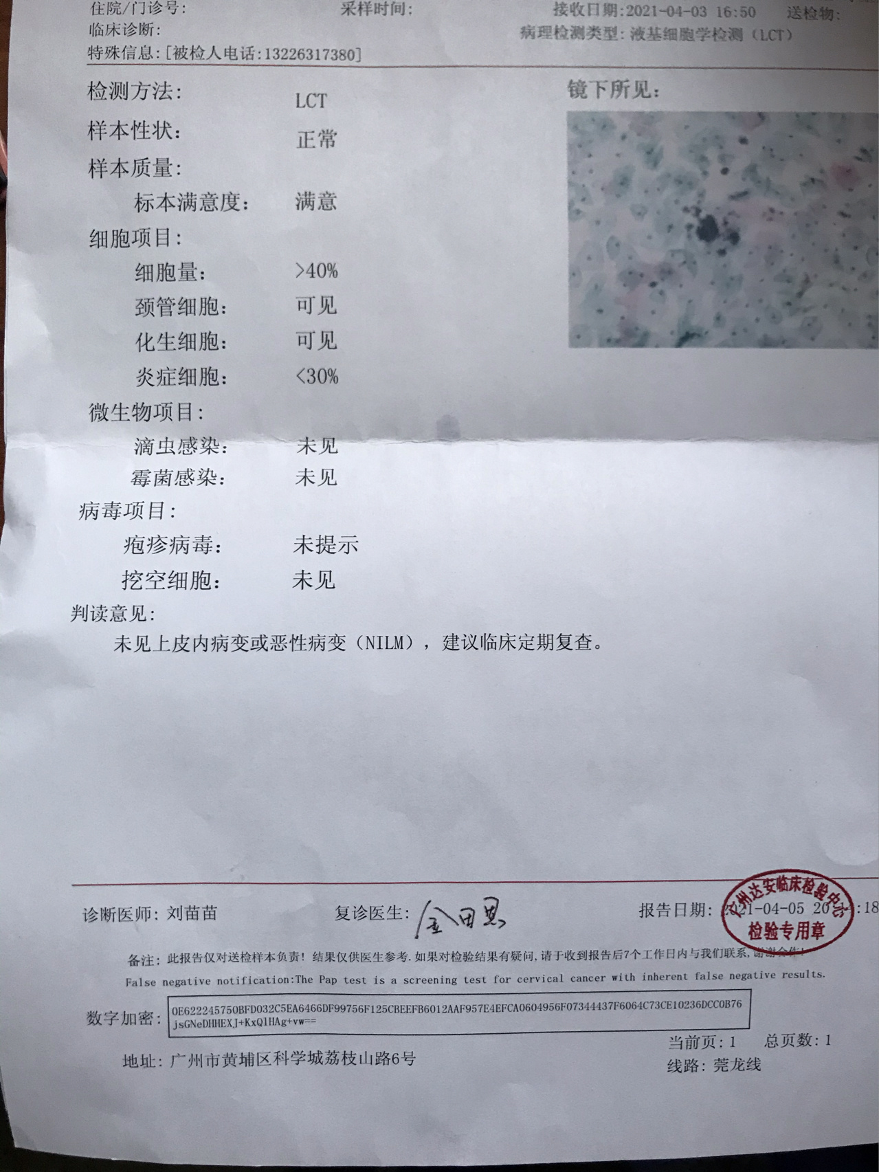 女人感染hpv52图片图片