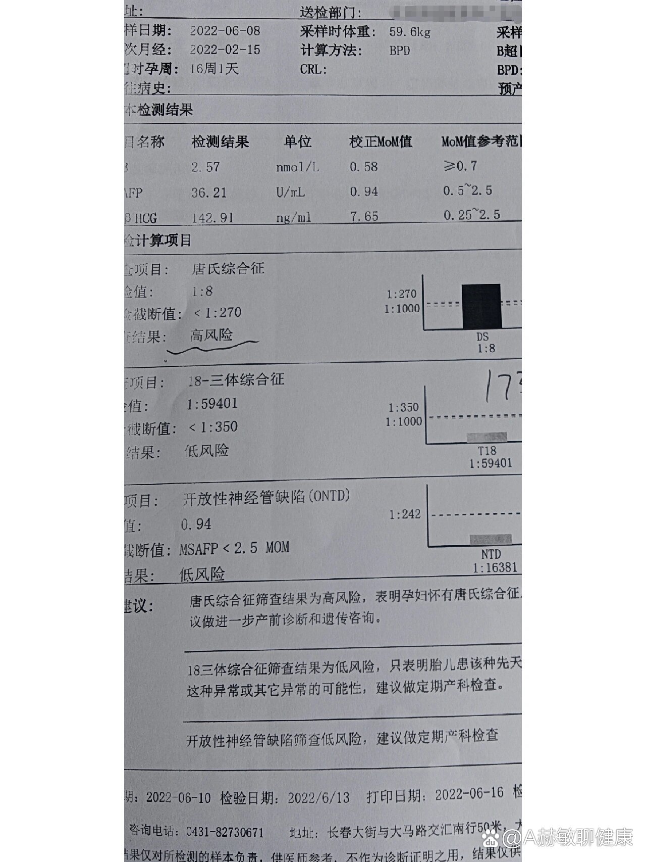 唐筛报告高风险图片