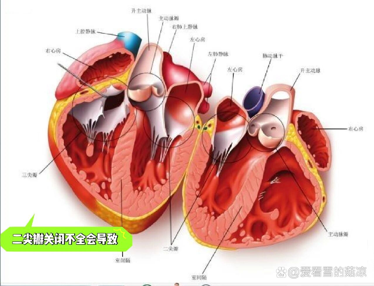 房室瓣半月瓣图片