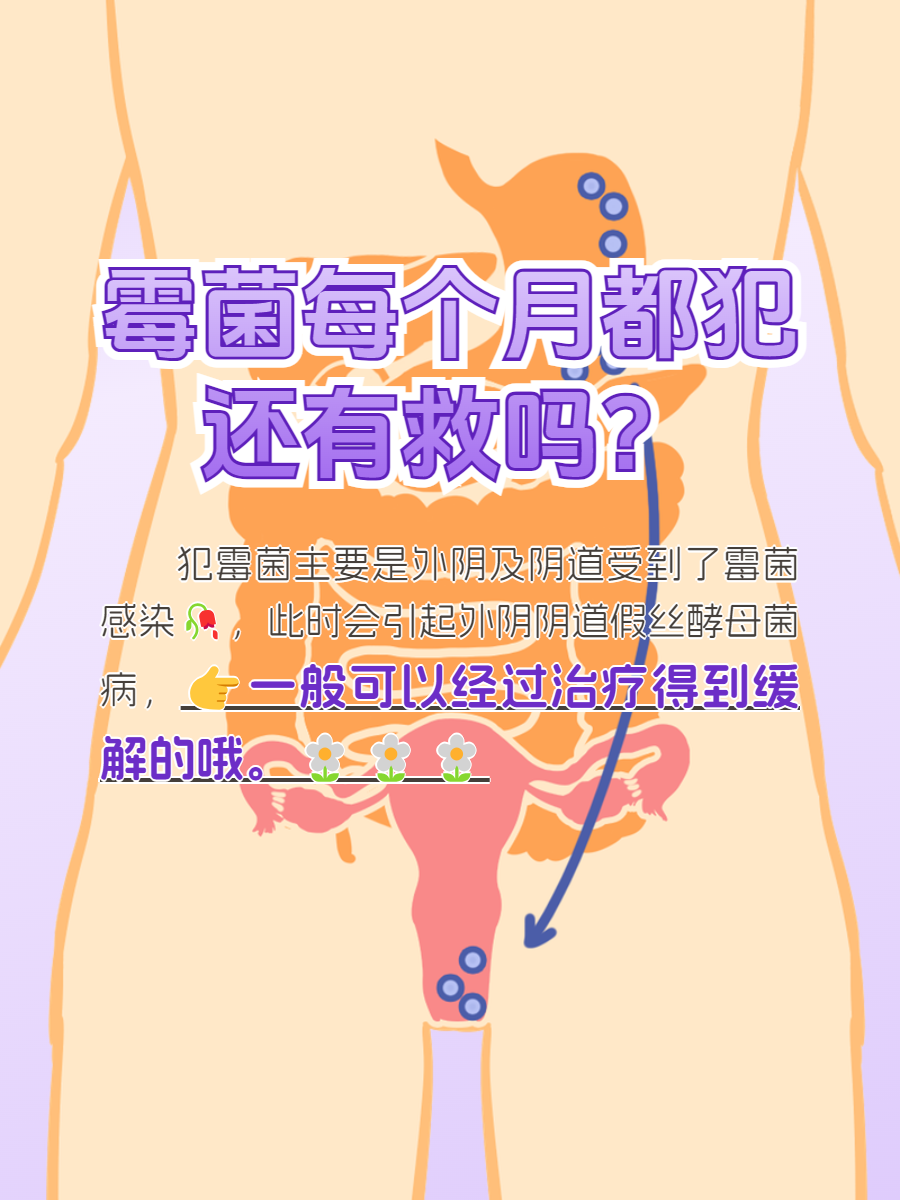 女性为什么会感染霉菌图片