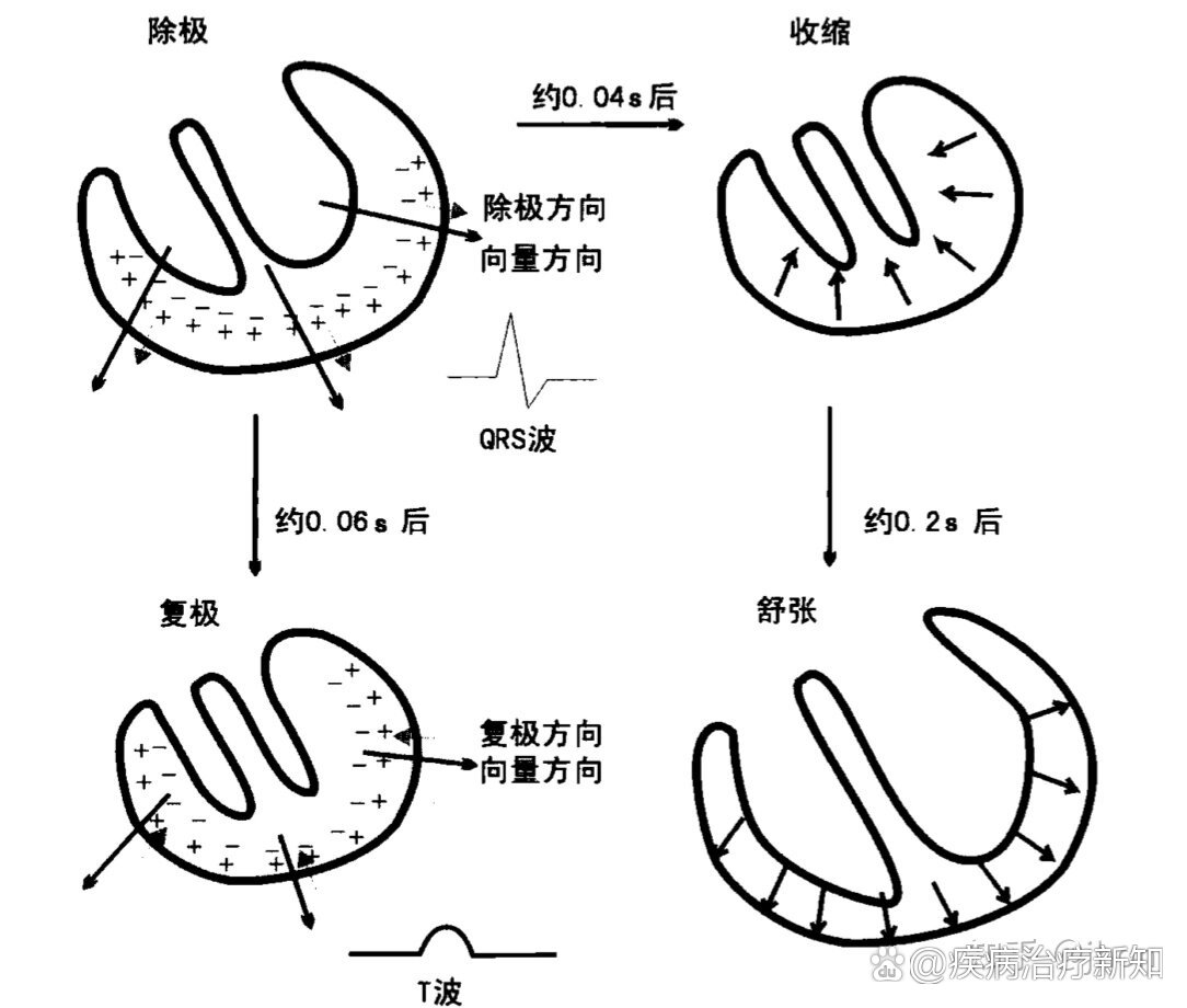 心脏除极顺序图解图片