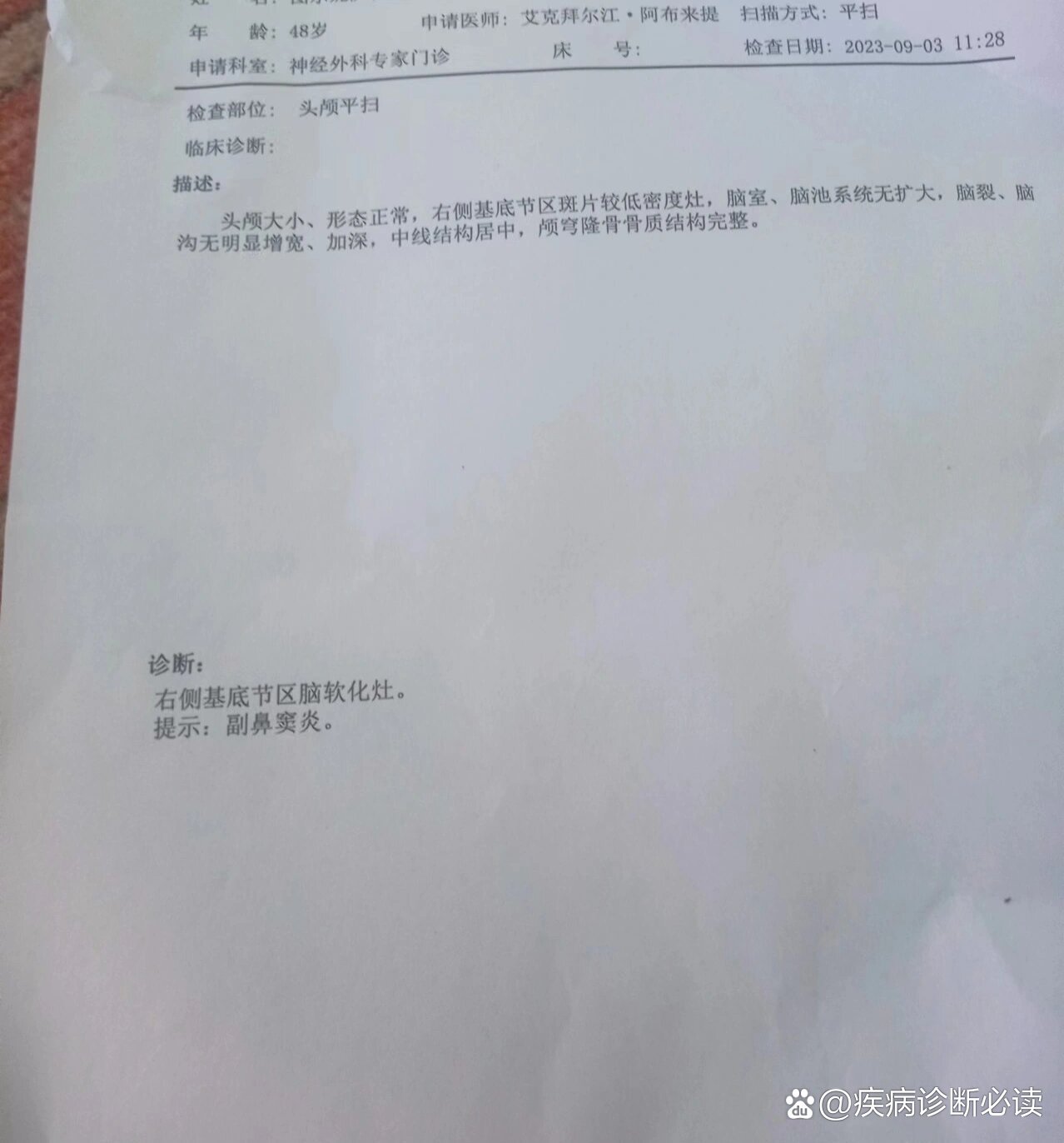 右侧基底节区软化灶