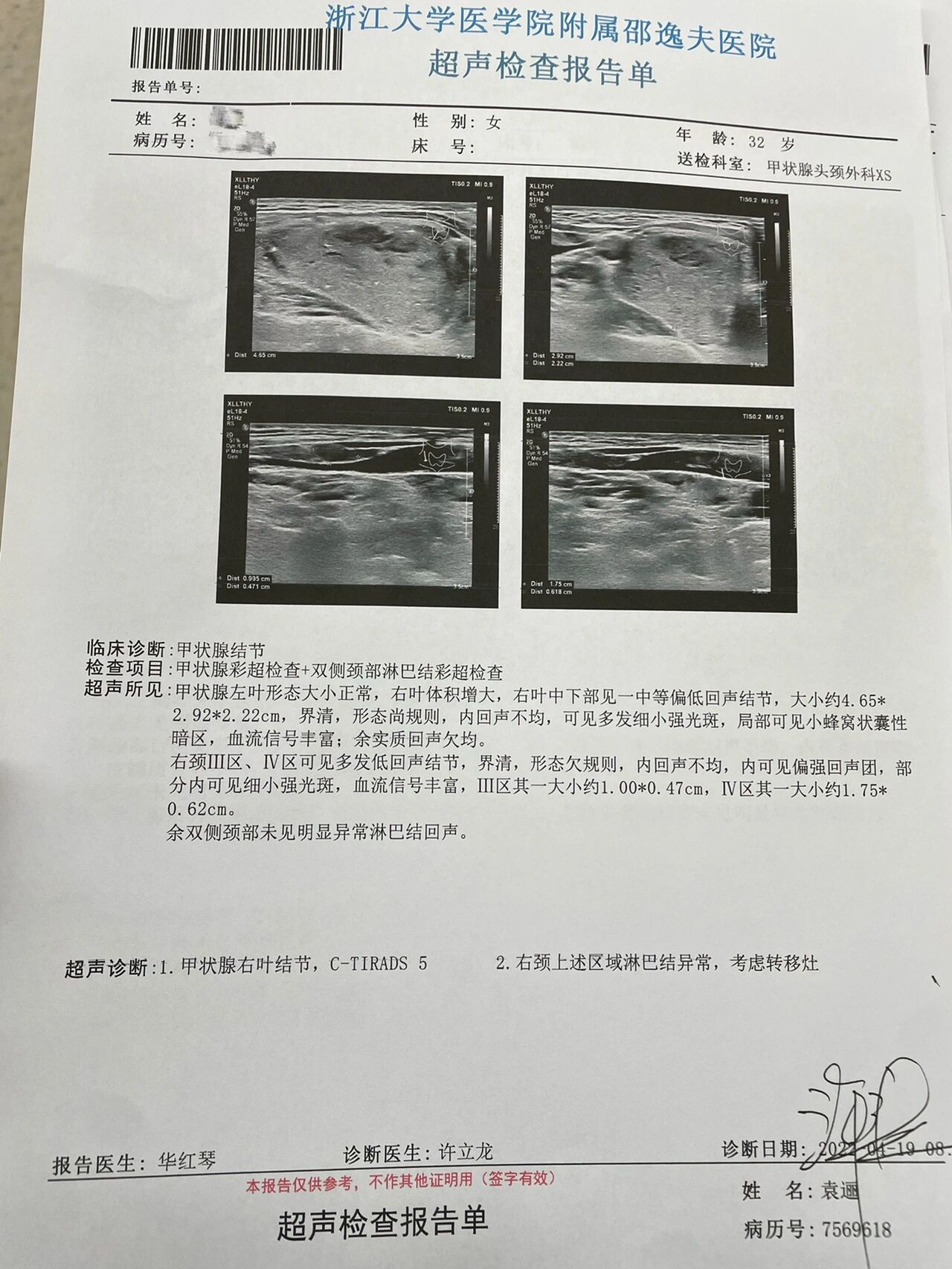 甲状腺乳头状癌检查篇