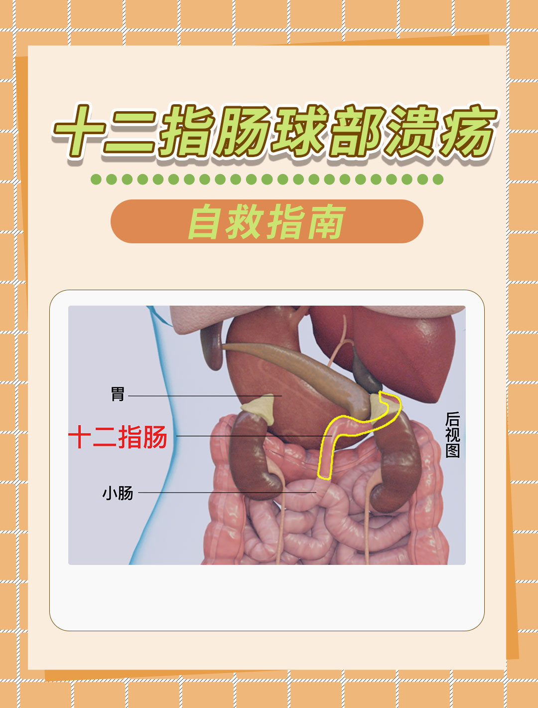 十二指肠解剖球部图片