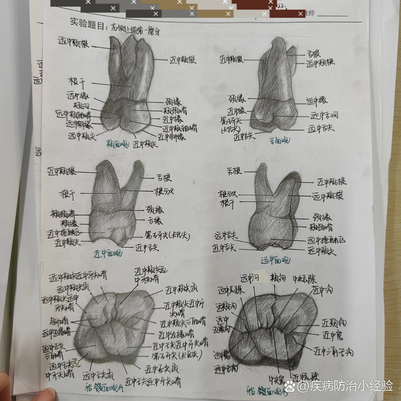 下颌第一磨牙模型图片