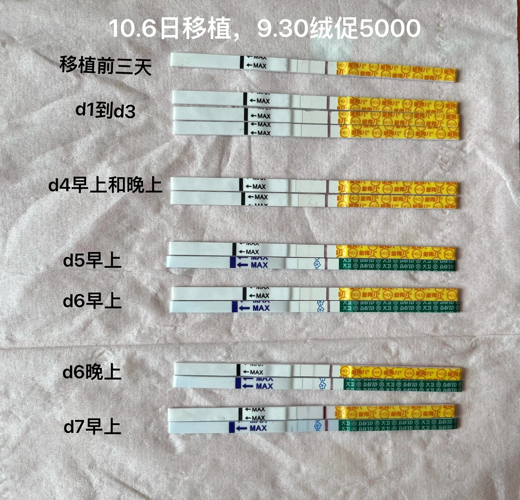 移植囊胚天数如何计算_移植囊胚天数如何计算时间