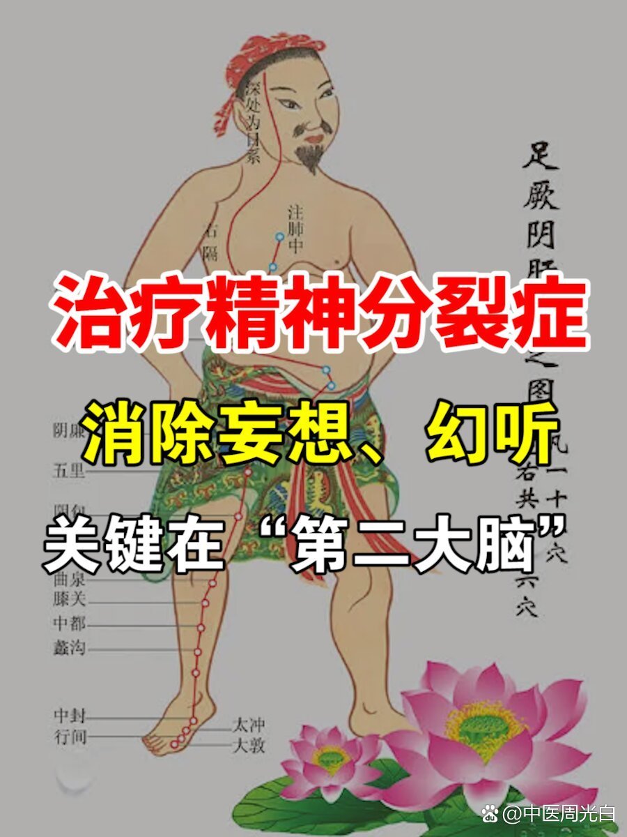 治精神分裂症，消妄想幻听——关键在“第二大脑”