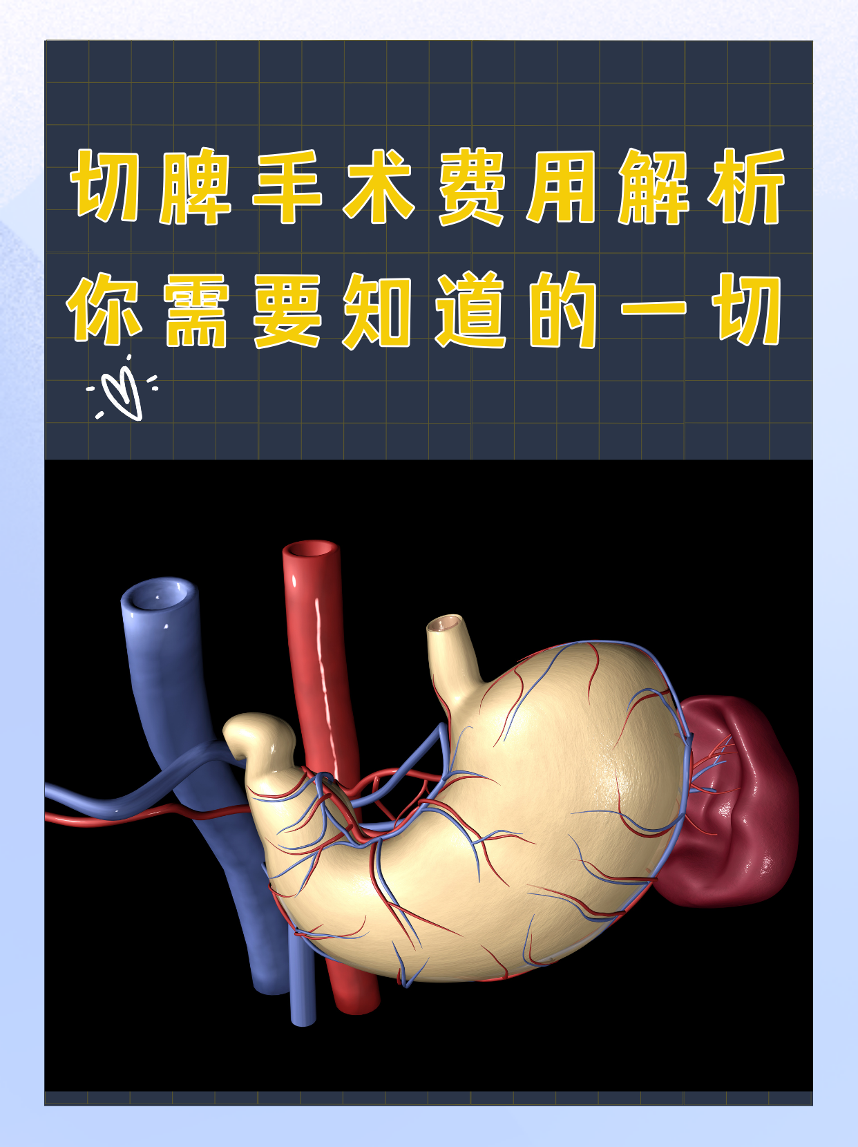 切脾手术费用解析:你需要知道的一切