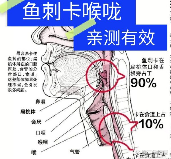【鱼刺卡住喉咙