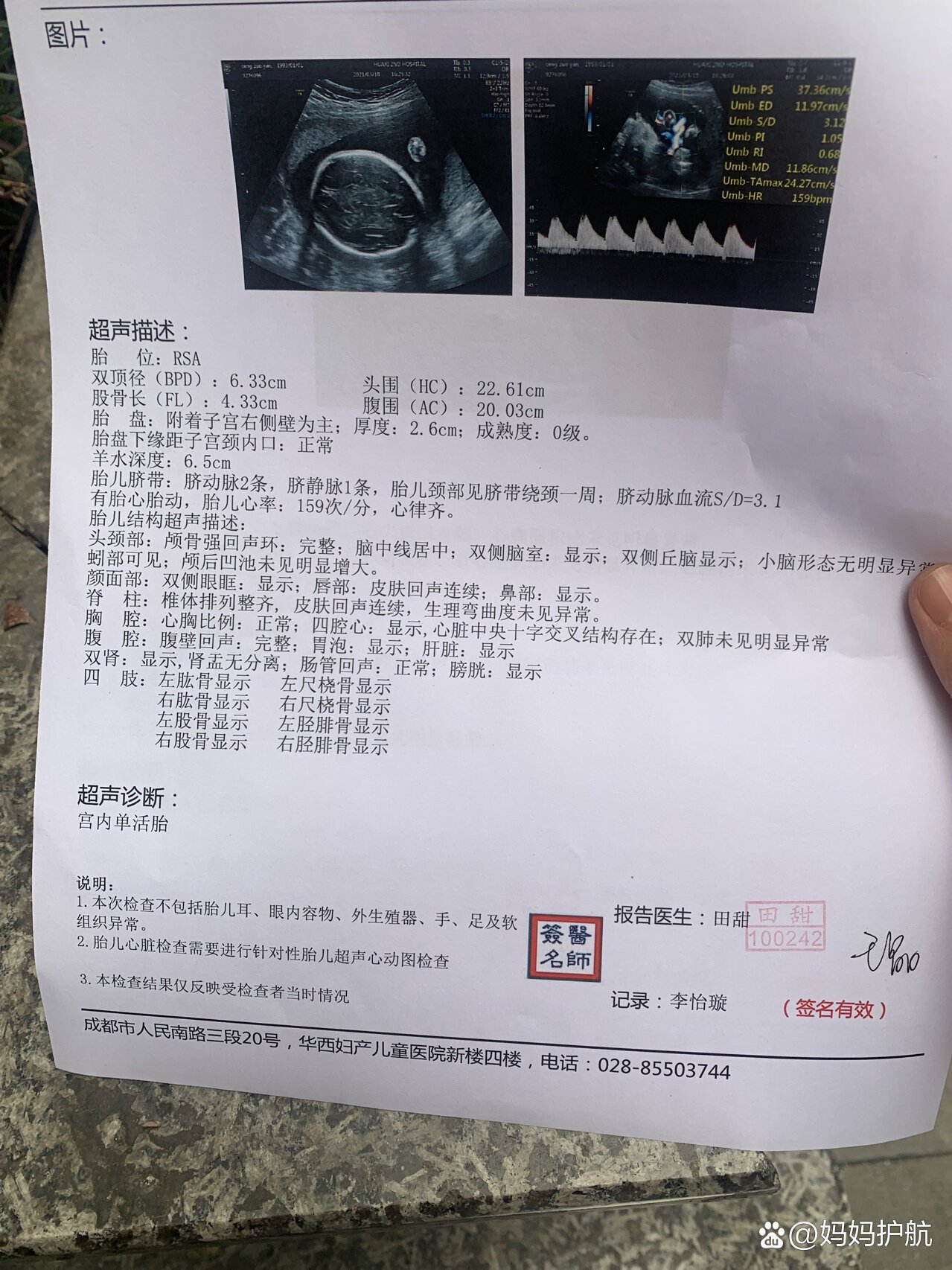 四维大排畸+胎儿心脏彩超+糖耐一次过