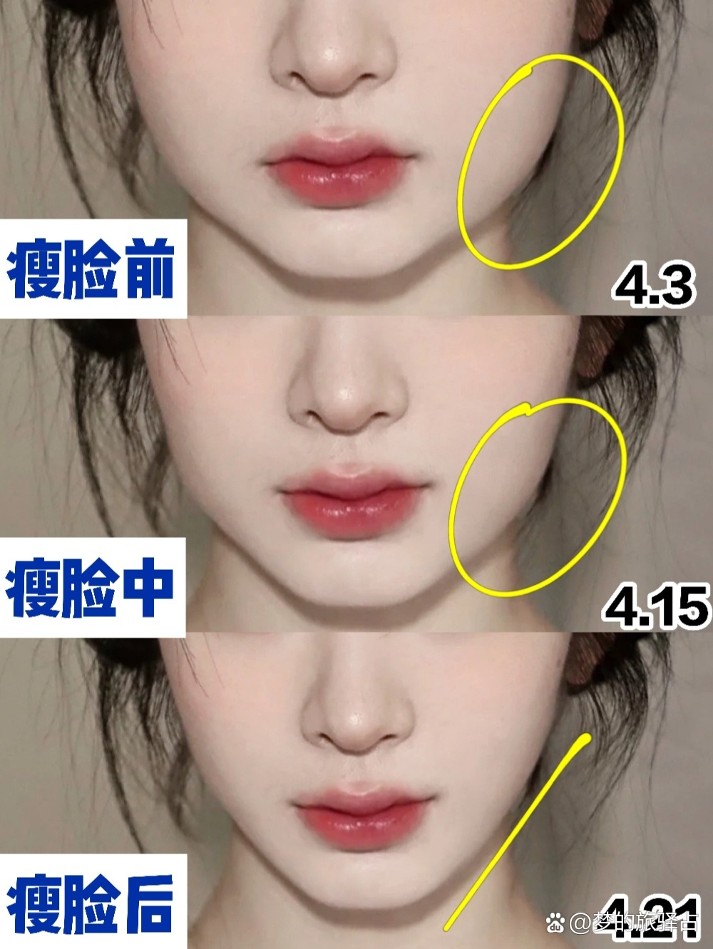 瘦脸须知73分享快速瘦脸成功的那些方法