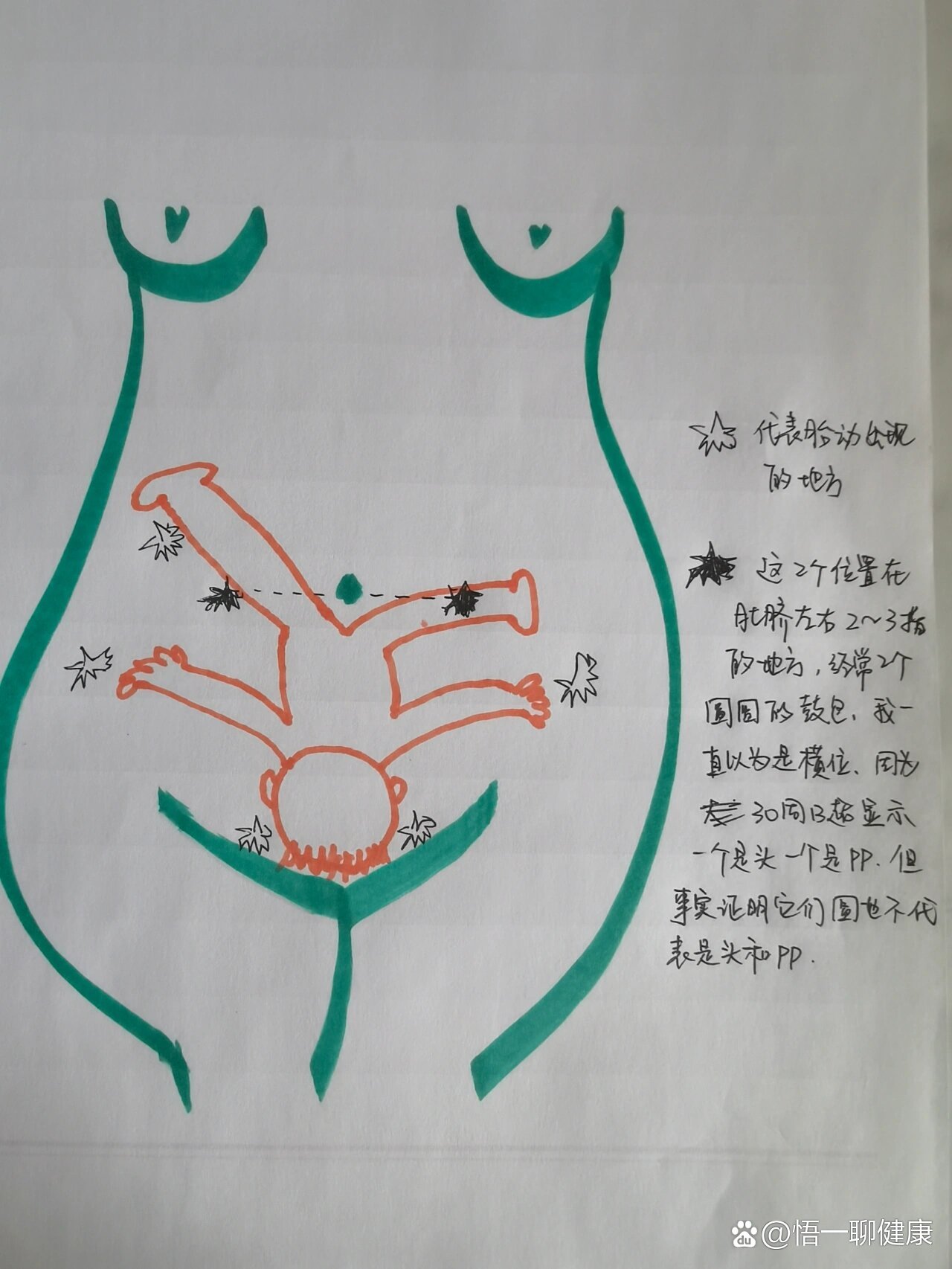 六种调整胎位的方法集合!