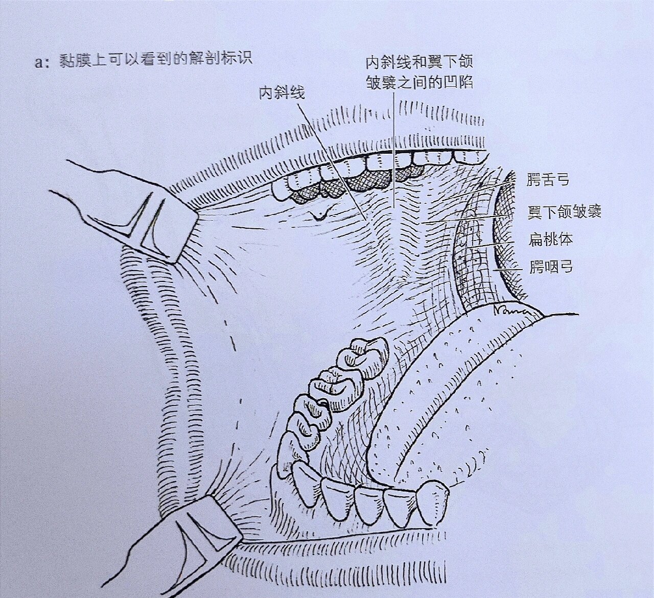 口腔麻醉神经分布图片图片