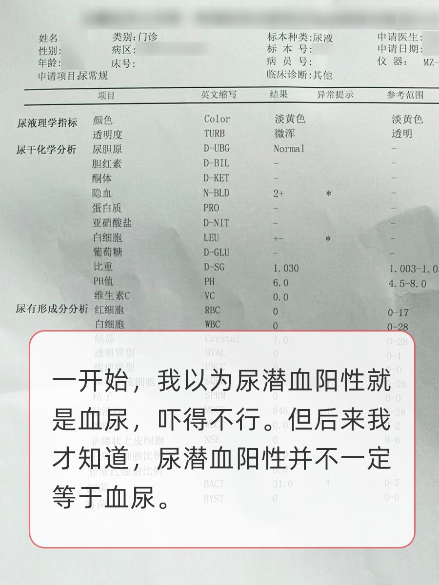 体检尿潜血阳性,我慌了