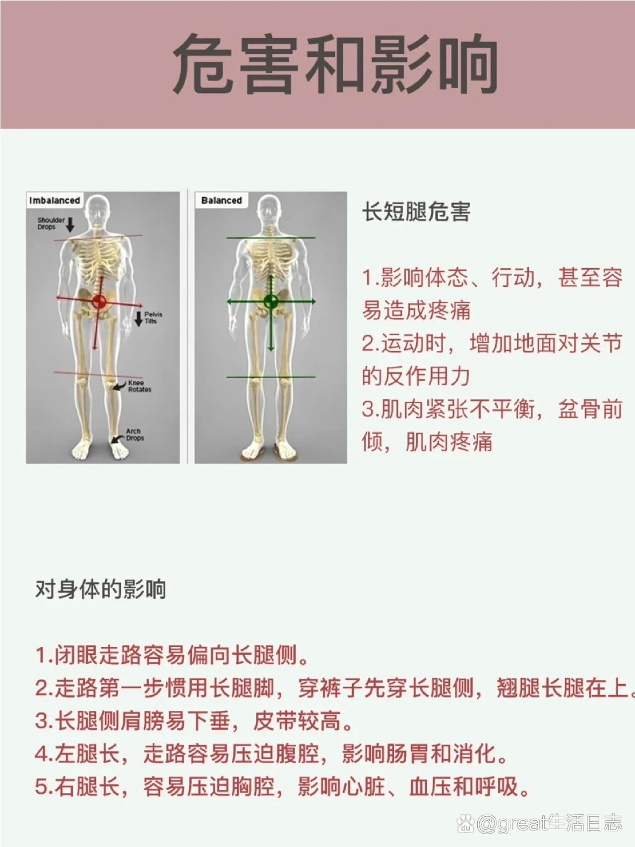 儿麻长短腿图片