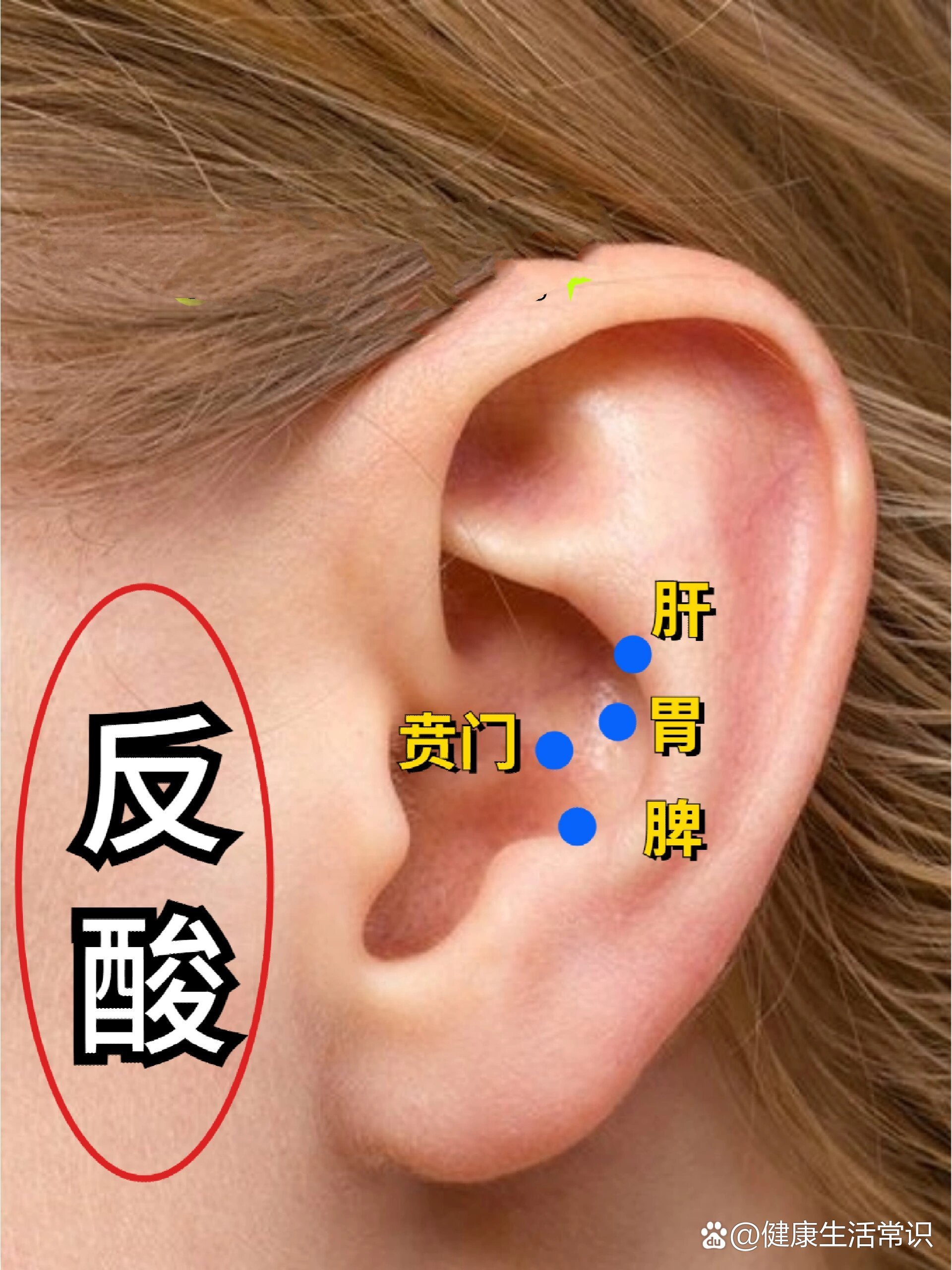 王不留行贴手指图图片