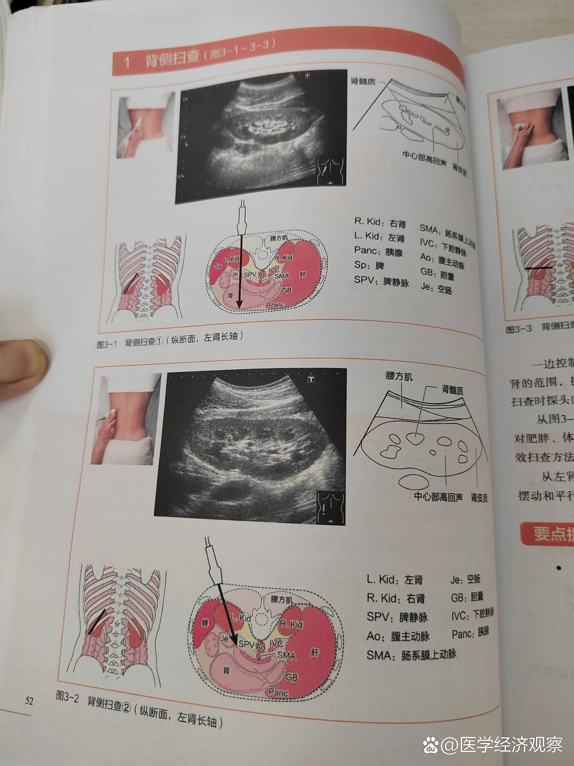 今日分享:超声肾脏扫查技巧