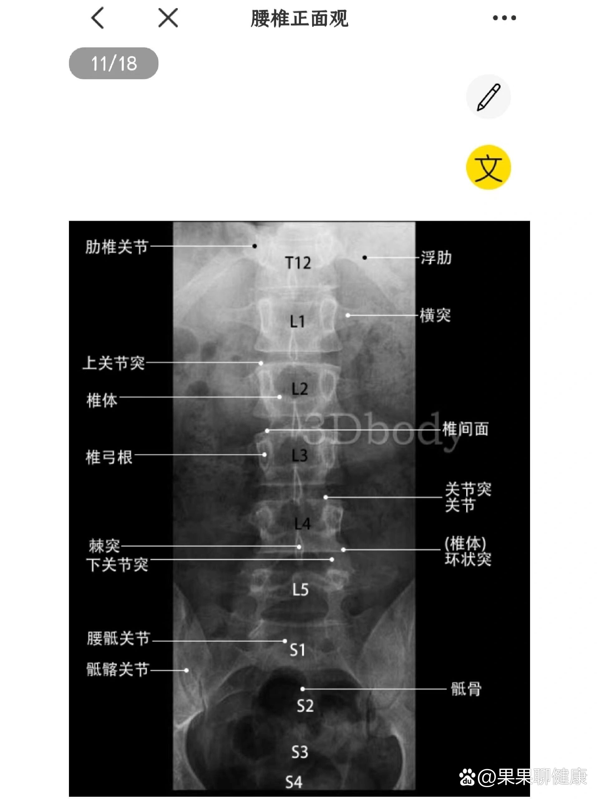 腰椎正侧位/医学生