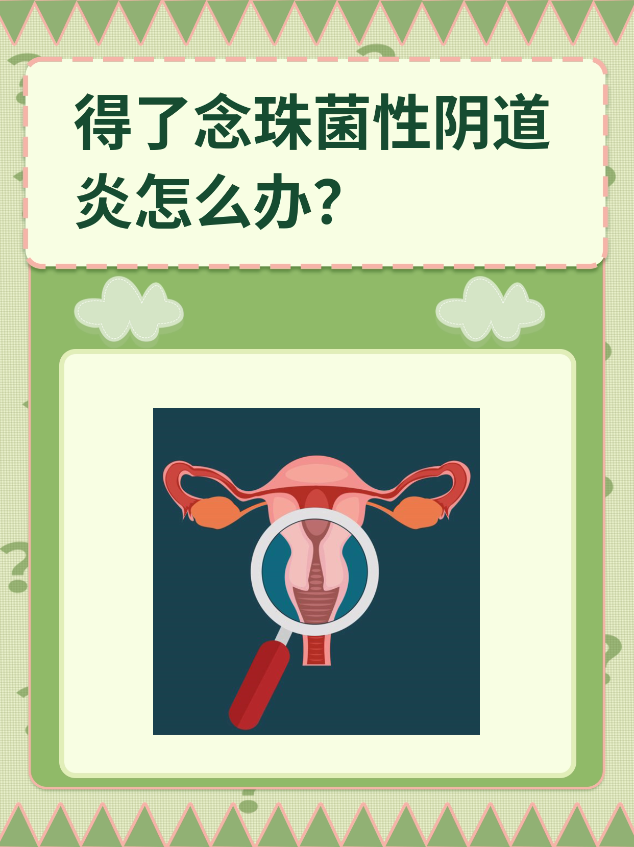 得了念珠菌性阴道炎怎么办