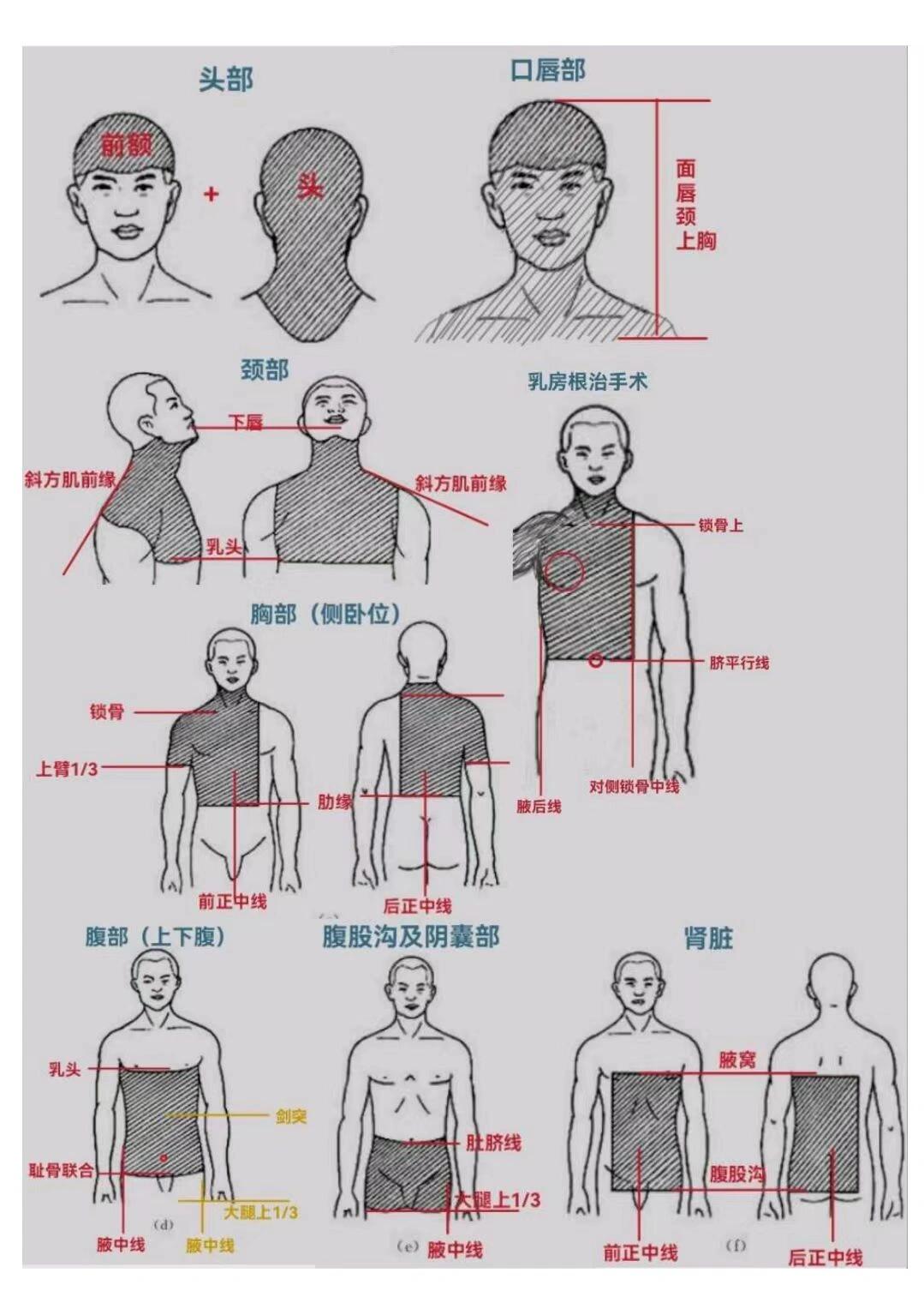 手术消毒范围图